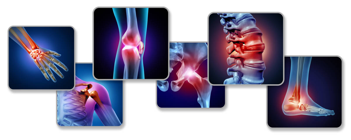 Fibromyalgie_iStock-1171639646
